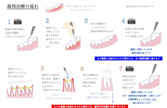 姫路で定期検診を丁寧に行っている歯医者｜なかじまデンタルクリニック